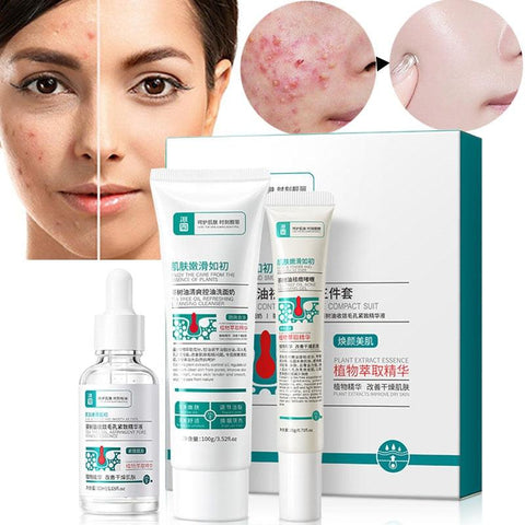 Herbal Acne Removal Face Cream - FajarShuruqSA