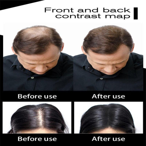 Hair Fibers Keratin Toppik Thickening Spray Hair Building Fibers 27.5g Loss Products Instant Wig Regrowth Powders - FajarShuruqSA